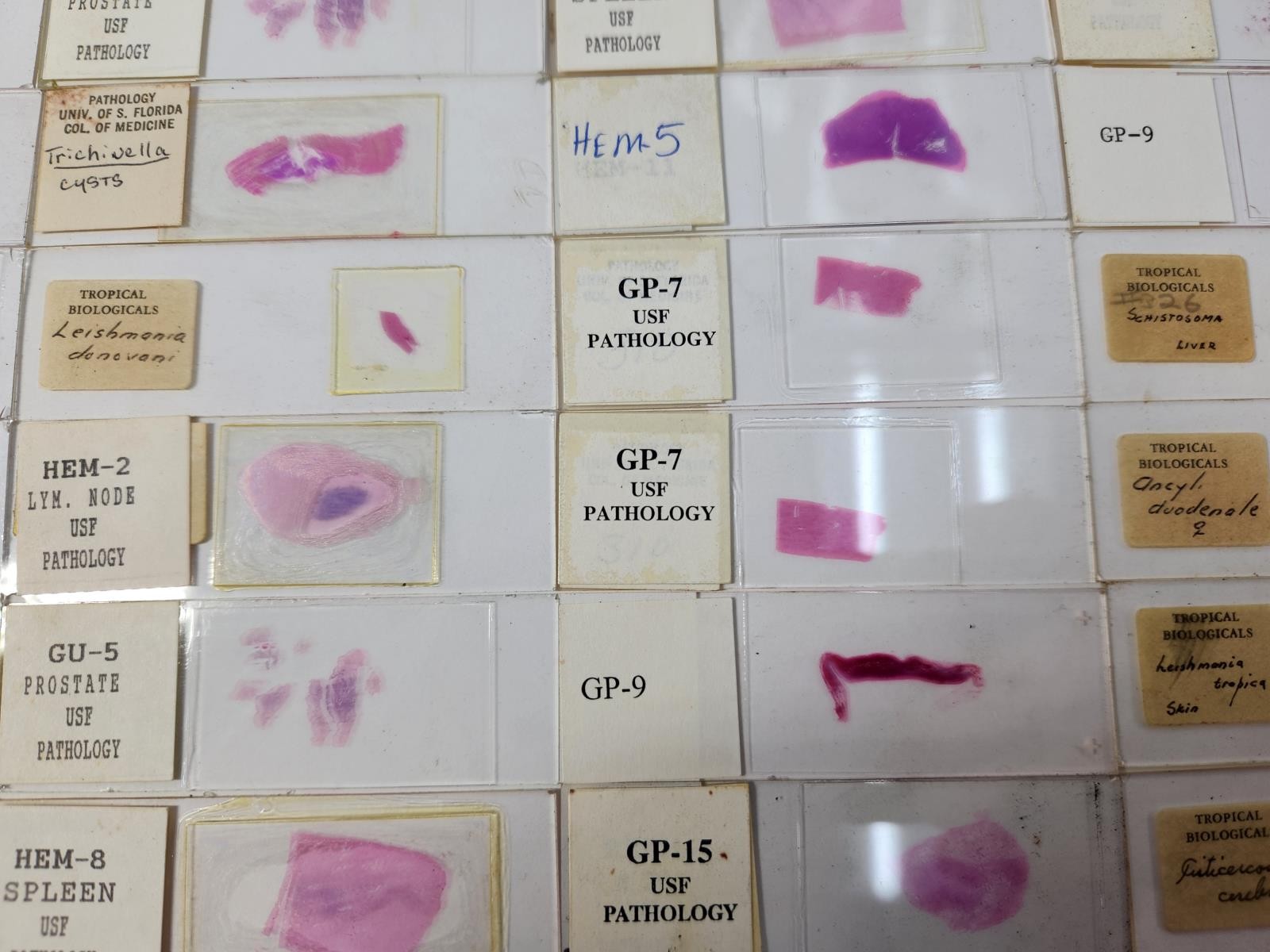 Lot Of 50 Vintage University Prepared Pathology Microscope Slides - Slides Only