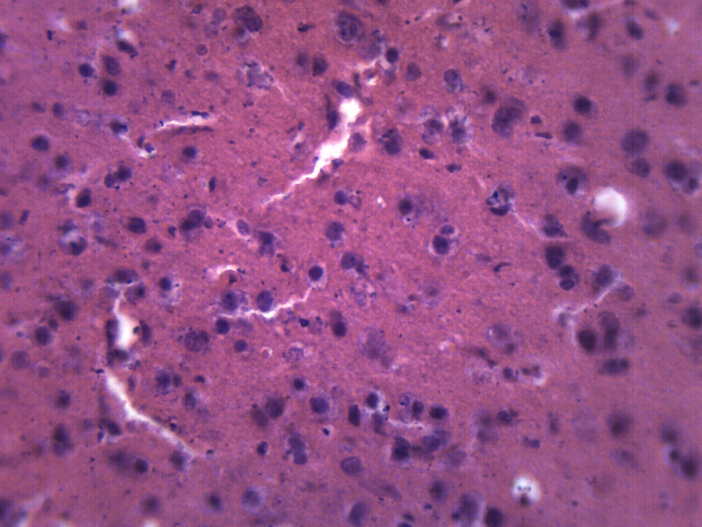 Brain Section - Prepared Microscope Slide - 75x25mm - Eisco Labs