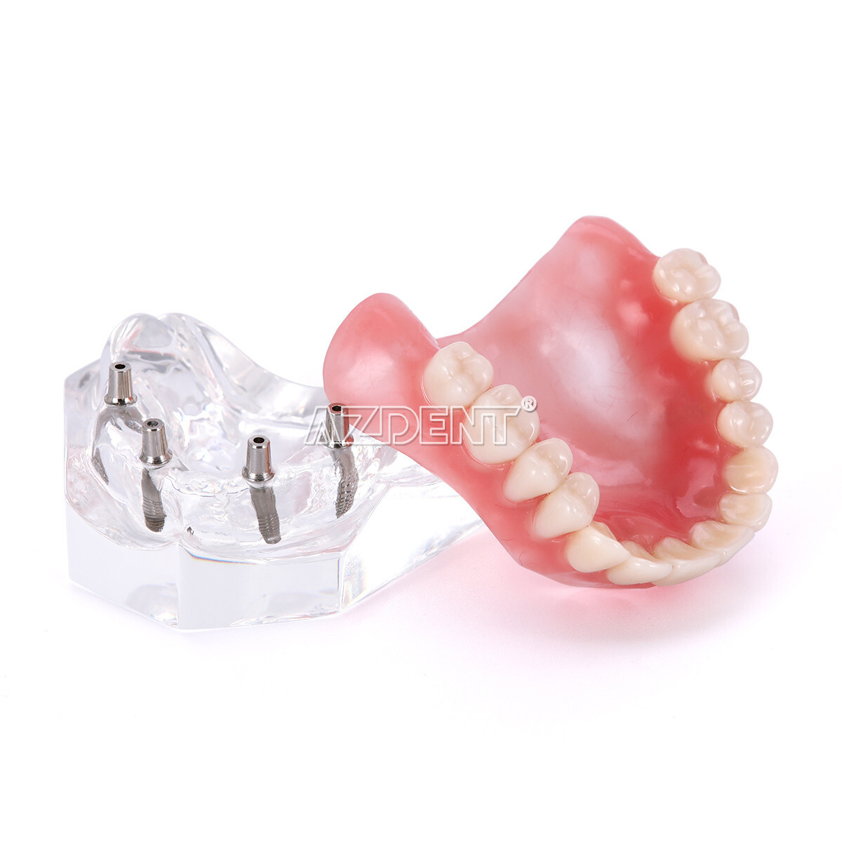Dental Overdenture Implant Teeth Model Denture with implant Demonstration Clear