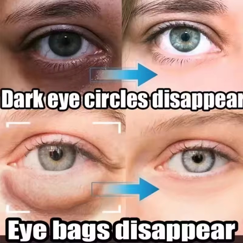 Under Eye Cream Remove Dark Circles Bags Face Lines Ageless Wrinkles Puffy Eye-