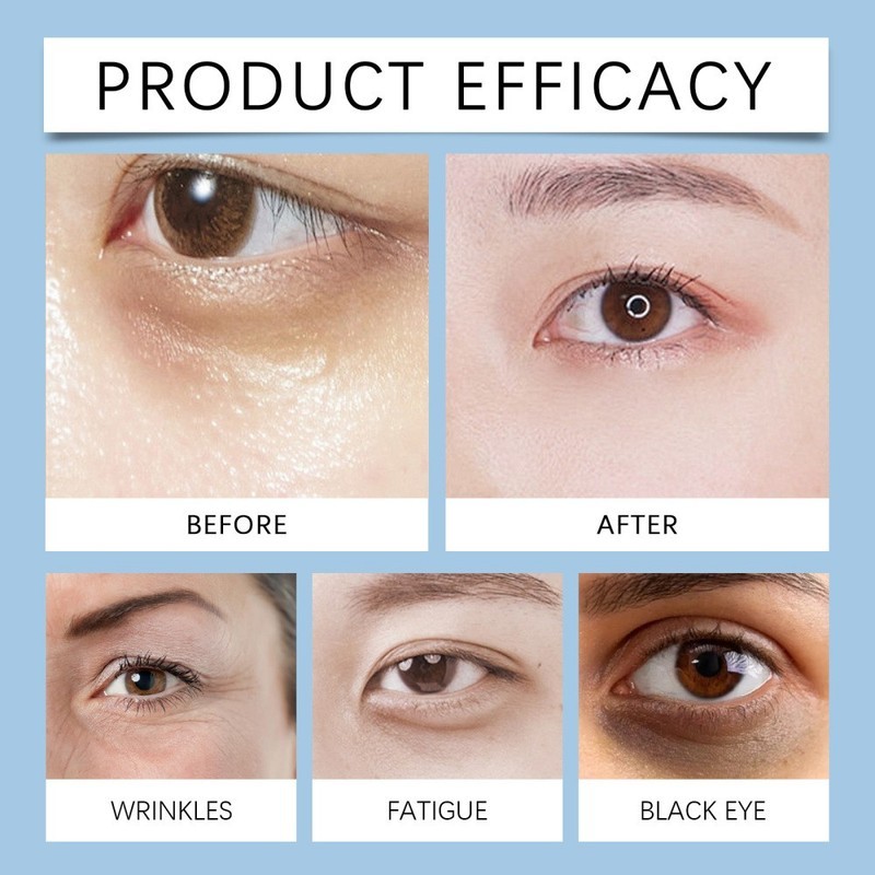 Under Eye Cream Remove Dark Circles Bags Face Lines Ageless Wrinkles Puffy Eye-