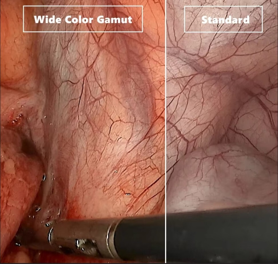 Gastrointestinal Bronchus Endoscopy With 360° Steering，Inclusive Biopsy Forceps