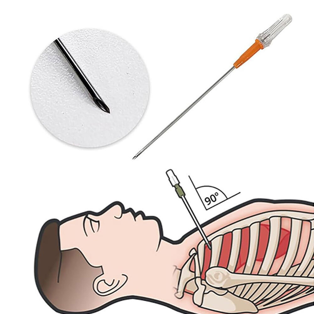 2pcs Rescue Tension Pneumothorax Needle Chest Decompression EDC First Aid 14G