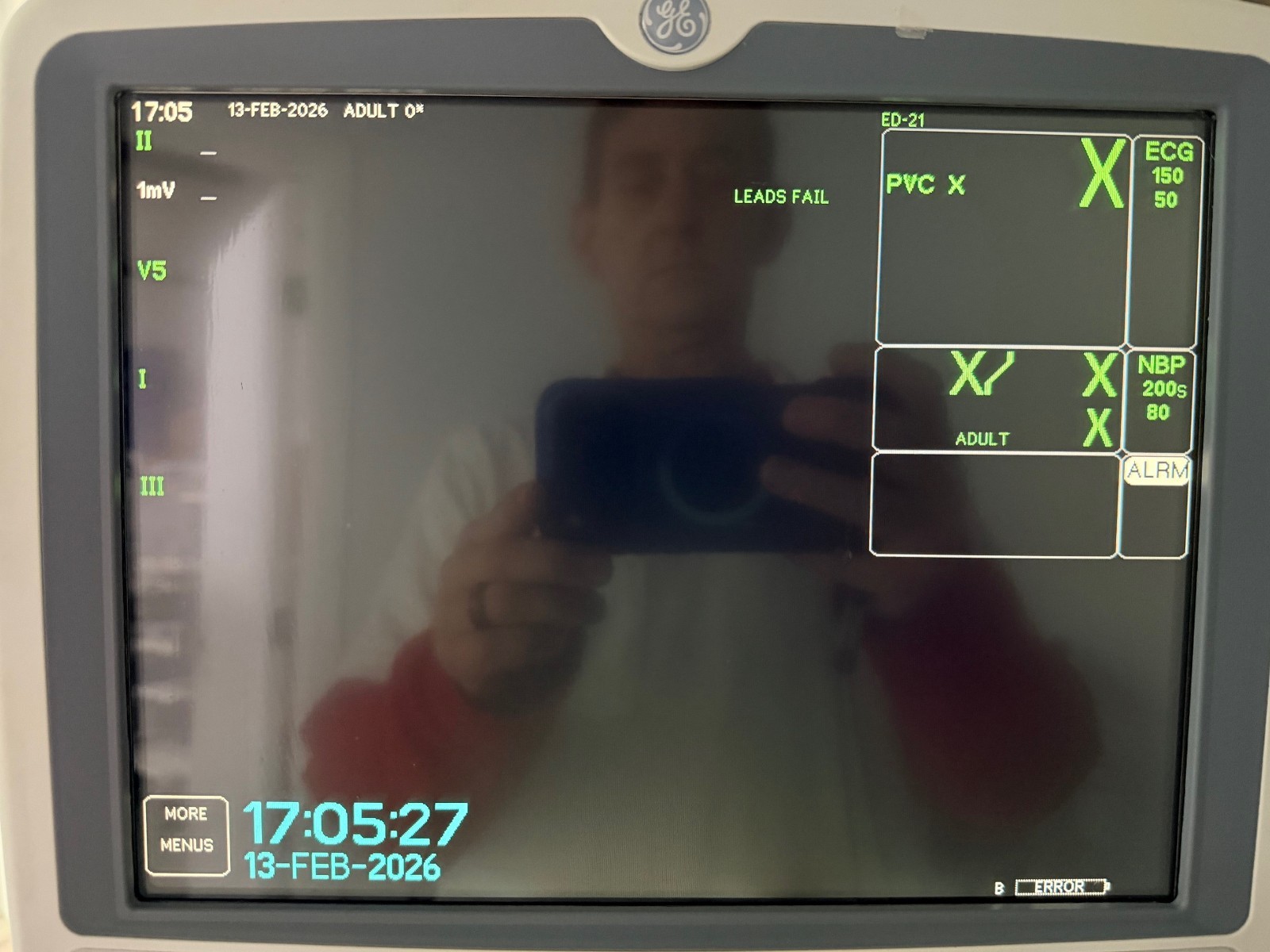 GE Dash 5000 Monitor w/ Rolling Stand, Clean/Tested/Warranty!!!