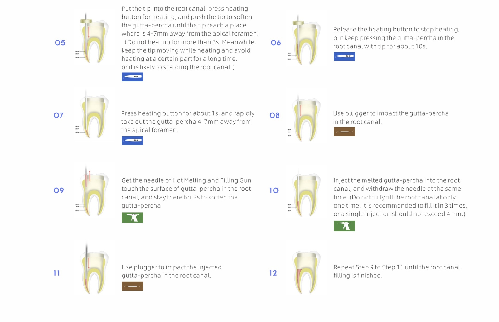 Woodpecker Dental Gutta Percha Pen Heated Tips for Endo Obturation System Fi-P