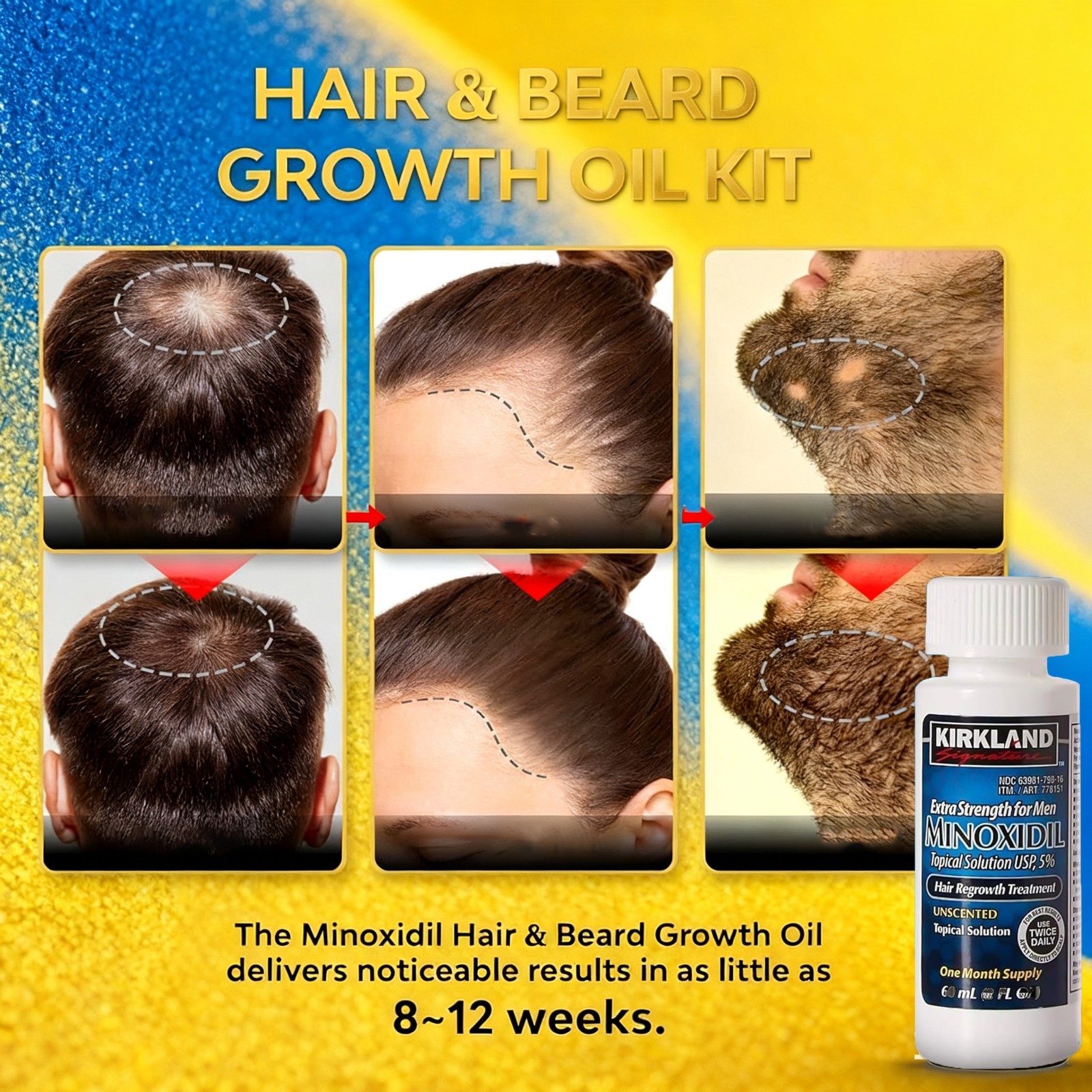 Kirkland Minoxidil 5% for Men & Women UniversalSolution for Pattern Baldness & T