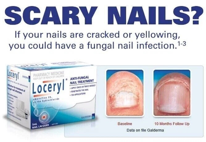 (The Latest) # Nail Fungal Lacquer 2.5ML FREE & FAST SHIPPING World Wide