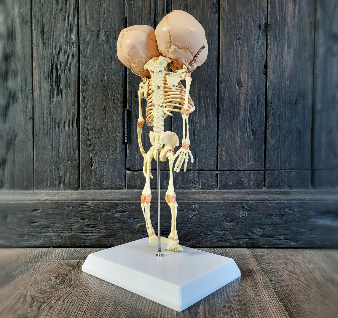 2 Headed Fetal Skeleton, Conjoined Twins Skeleton Model, 2 Head Baby, Oddities
