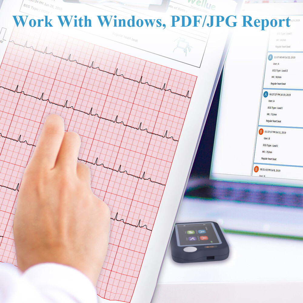 ECG EKG Monitor 30s/60s/5min Recording AI-ECG Analysis Report in App PC Software