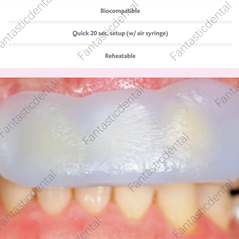Dental Thermoplastic Temp Tabs Quick Impressions Wax for Fabricating Temporaries
