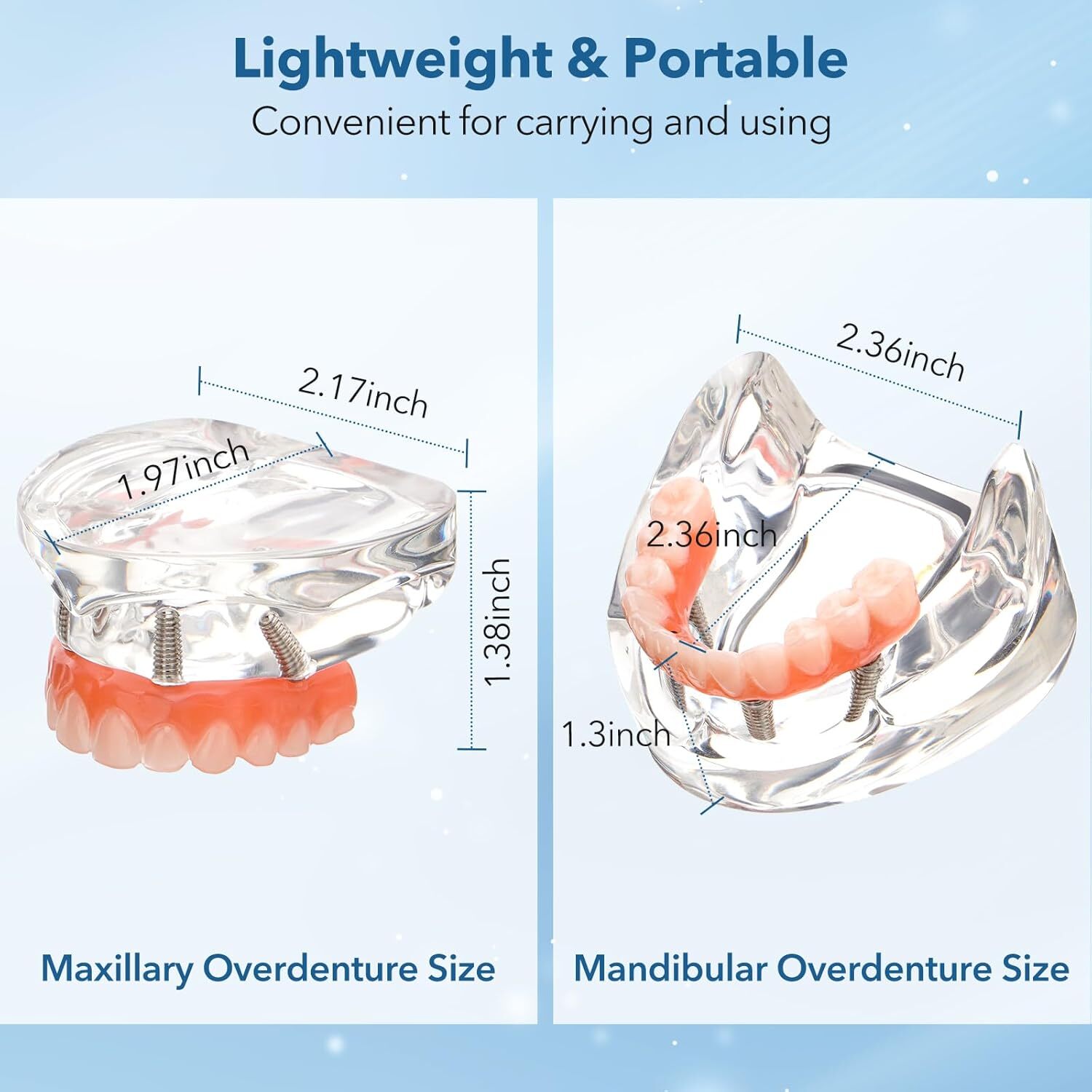 Dental Implant All-on-4 Overdenture Treatment Model Upper/Lower 4 Implants Clear
