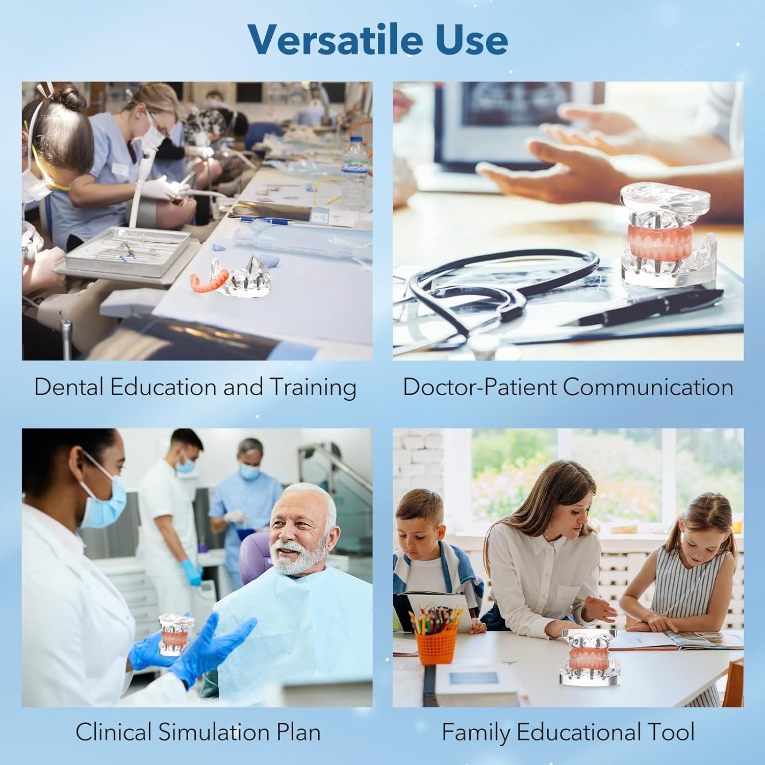 2pcs All-on-4 Dental Implant Model Upper/Lower Jaw Removable Screws Transparent