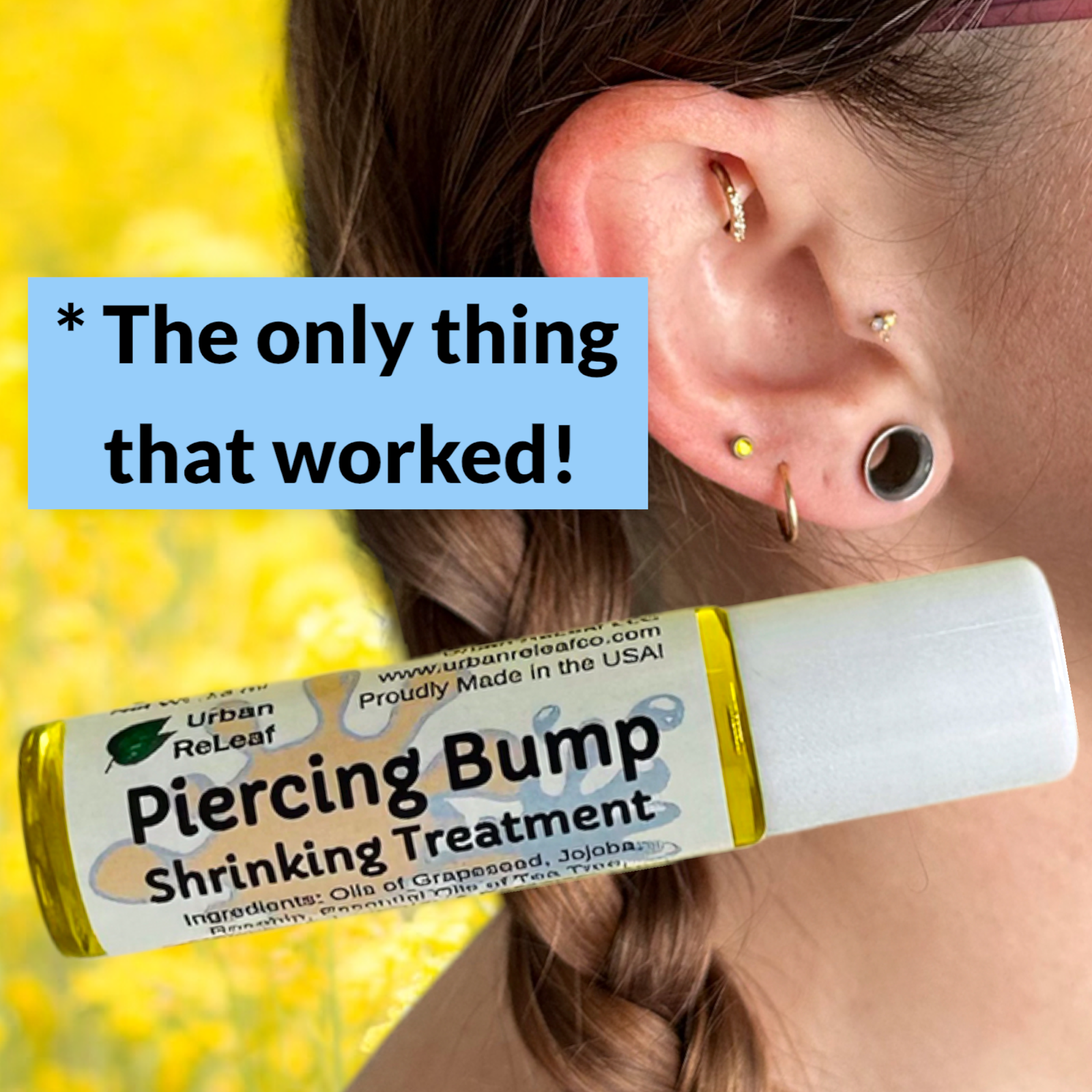 Urban ReLeaf Piercing Bump Shrinking Treatment! Aftercare Keloid Scar Cartilage