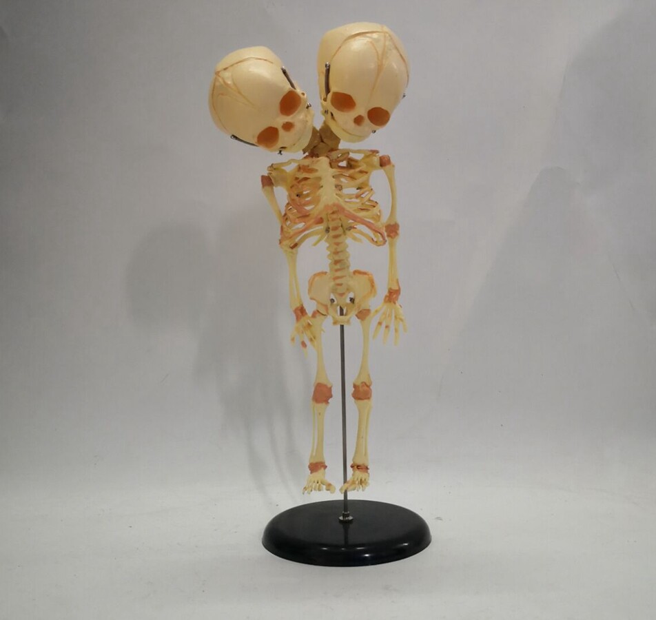 Fetal fetus Skeleton teaching educational Model Double Head Baby Skull Skeleton