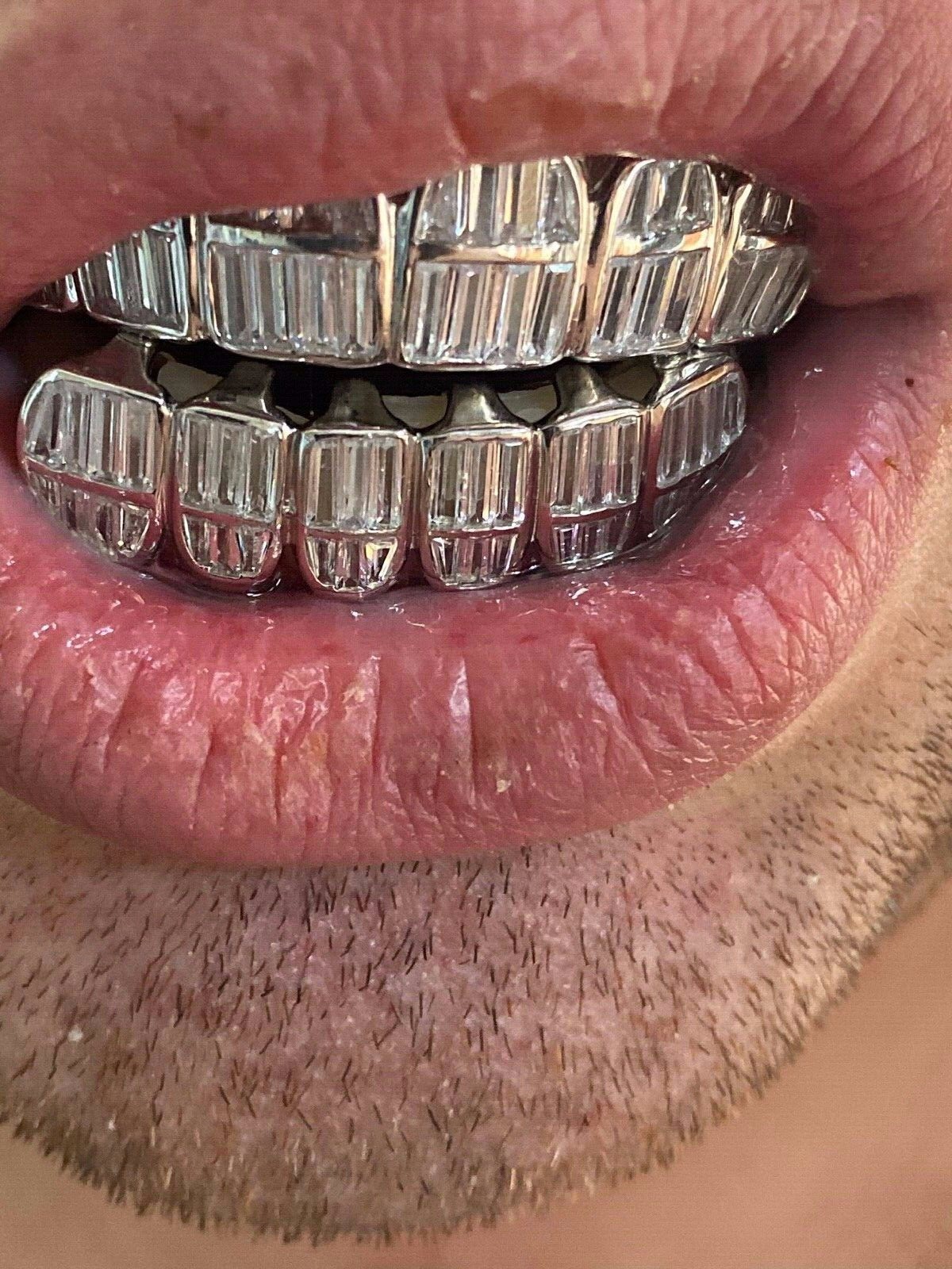 Real 925 Sterling Silver ICED Baguette Rapper GRILLZ Teeth Top & Bottom Set ICY