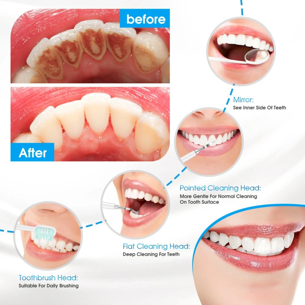 Electric Tooth Cleaner Dental Tools Plaque Calculus Remover Teeth Cleaning Kits