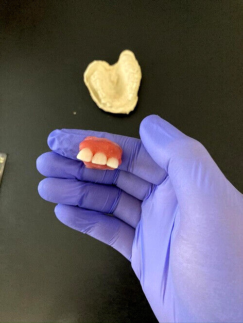 DIY DENTURE KIT Custom Dentures made at home FREE Priority Ship FULL PARTIAL