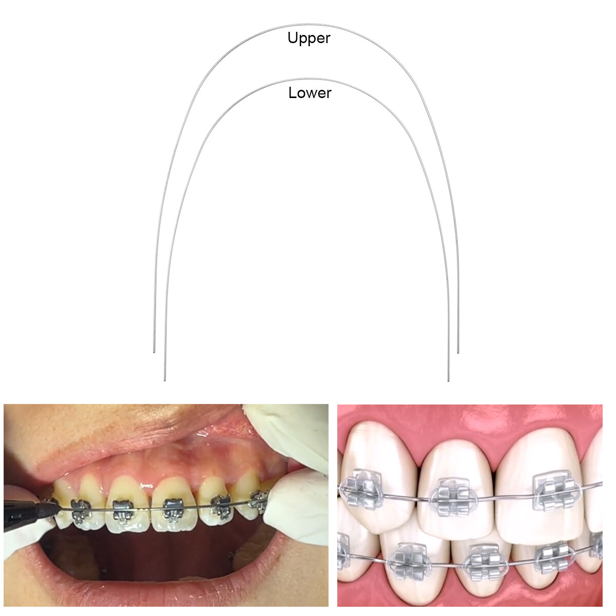 ortodoncia dental súper elástica niti arco cables Forma ovoide rectangular