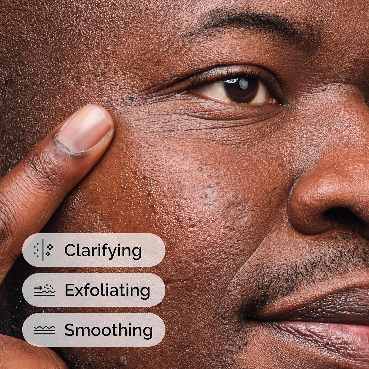 The Ordinary Salicylic Acid 2% Exfoliating Blemish Solution 1oz Anti-Acne Serum