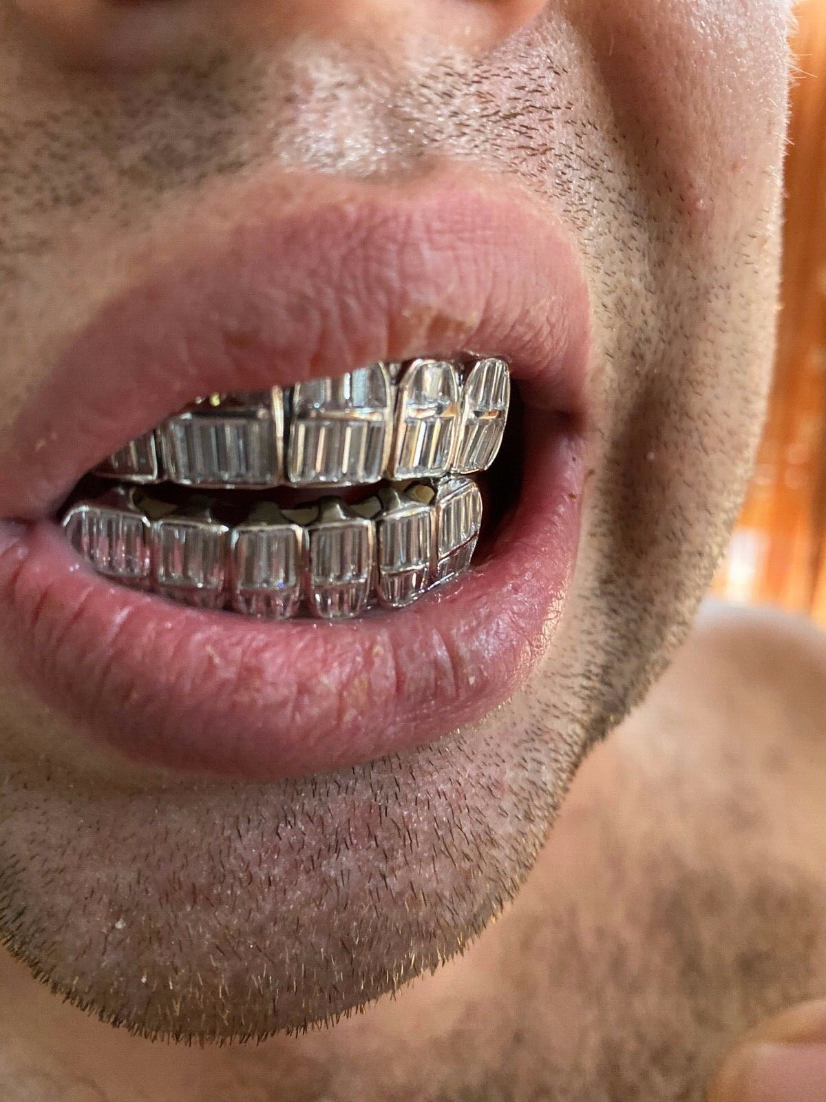 Real 925 Sterling Silver ICED Baguette Rapper GRILLZ Teeth Top & Bottom Set ICY