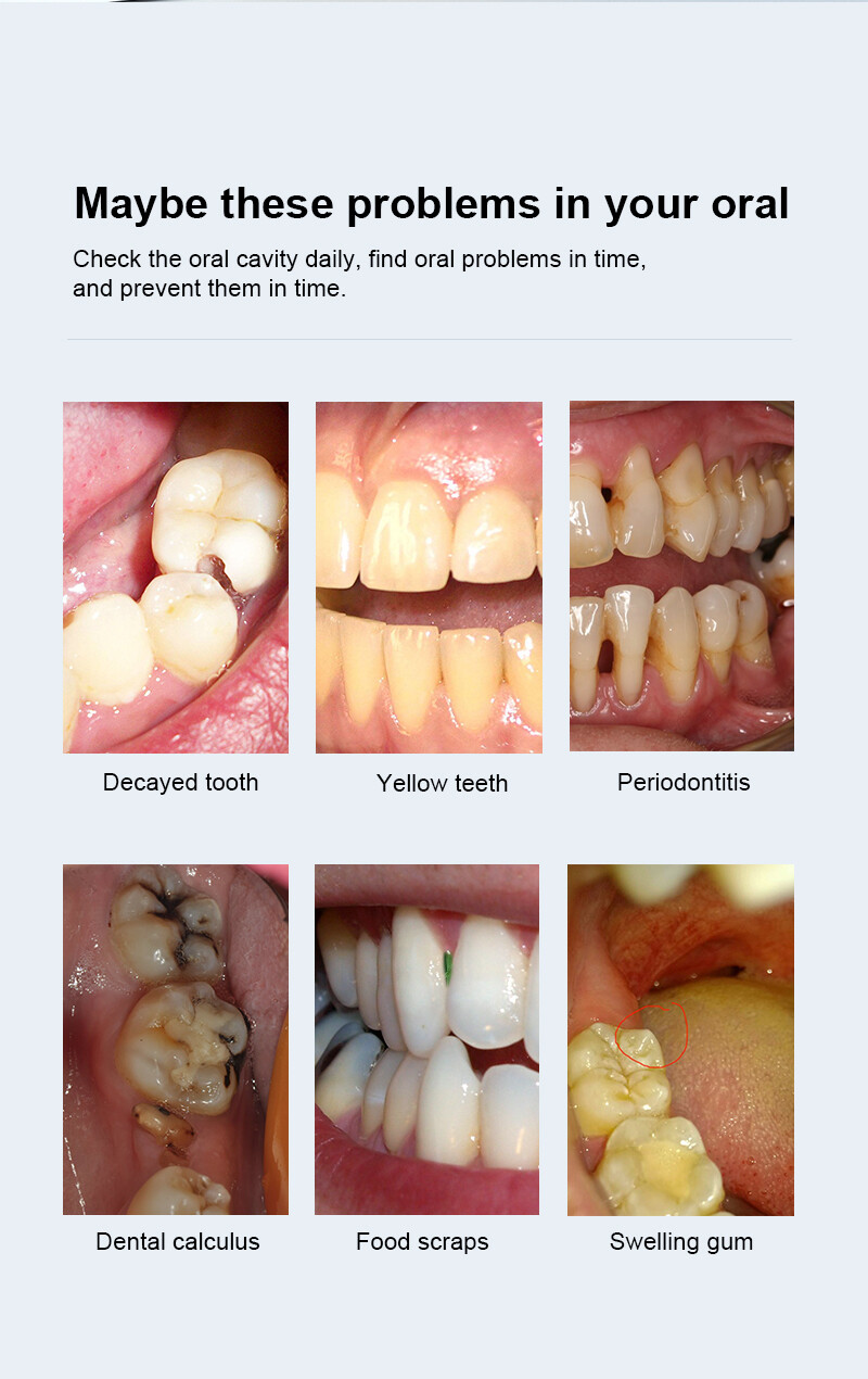 8pcs Led Light 3MP Dental Oral Camera Wireless Dental Intraoral Camera