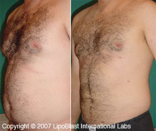 Best Diet Pills For Men & Women That Work Fast! Rapid Weight Loss Fat Burners