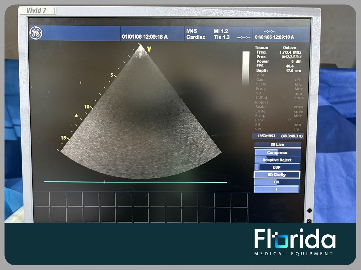 2007 GE M4S SECTOR ARRAY ULTRASOUND TRANSDUCER PROBE REF: 5129041 TESTED