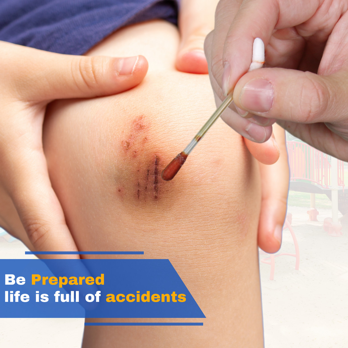 100 Pack Frontline Iodine Swabs Antiseptic Povidone Wound Cleaning Cotton Swabs