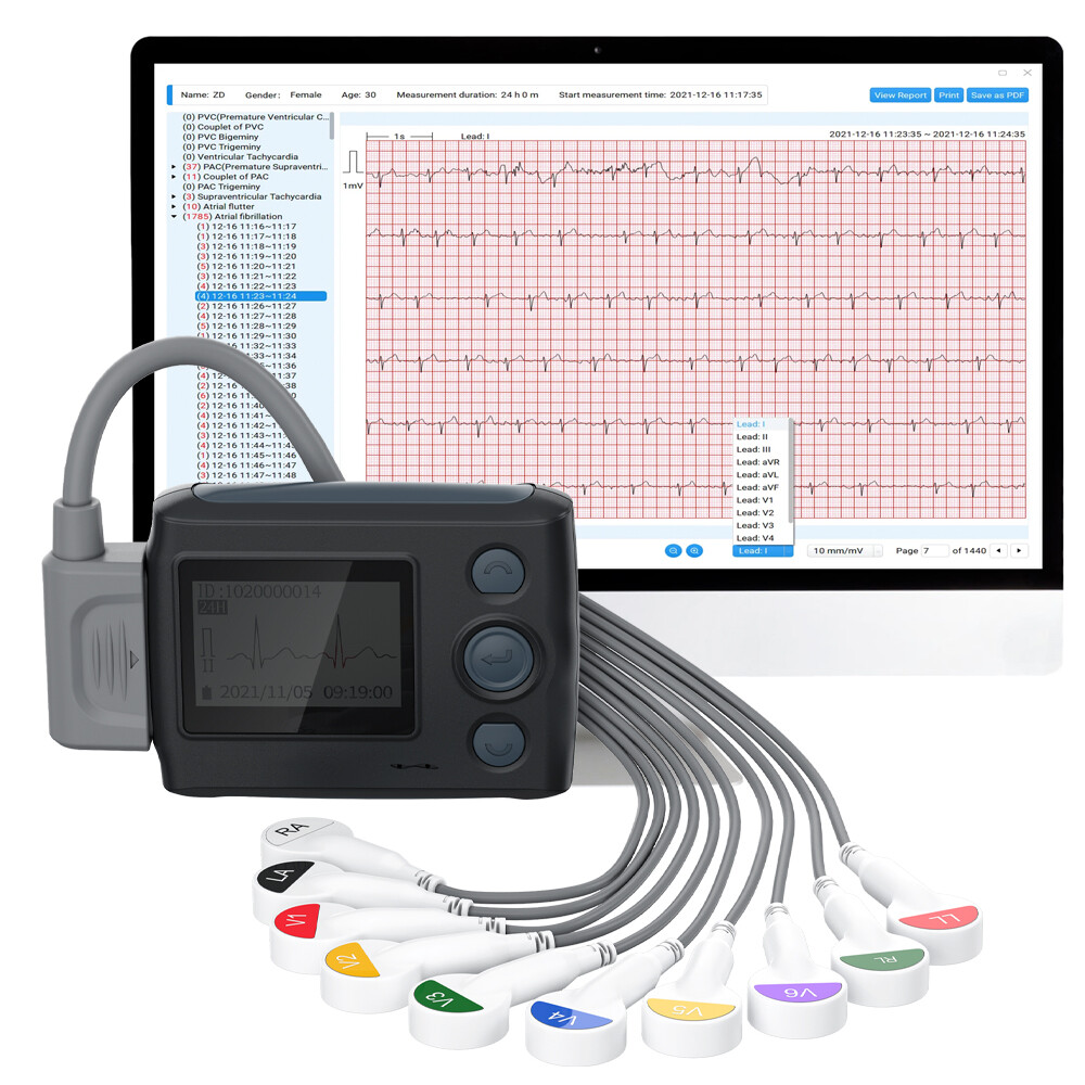12 Lead Holter Monitor Recording 24h ECG and Heart Rate AI Analysis Abnormal ECG