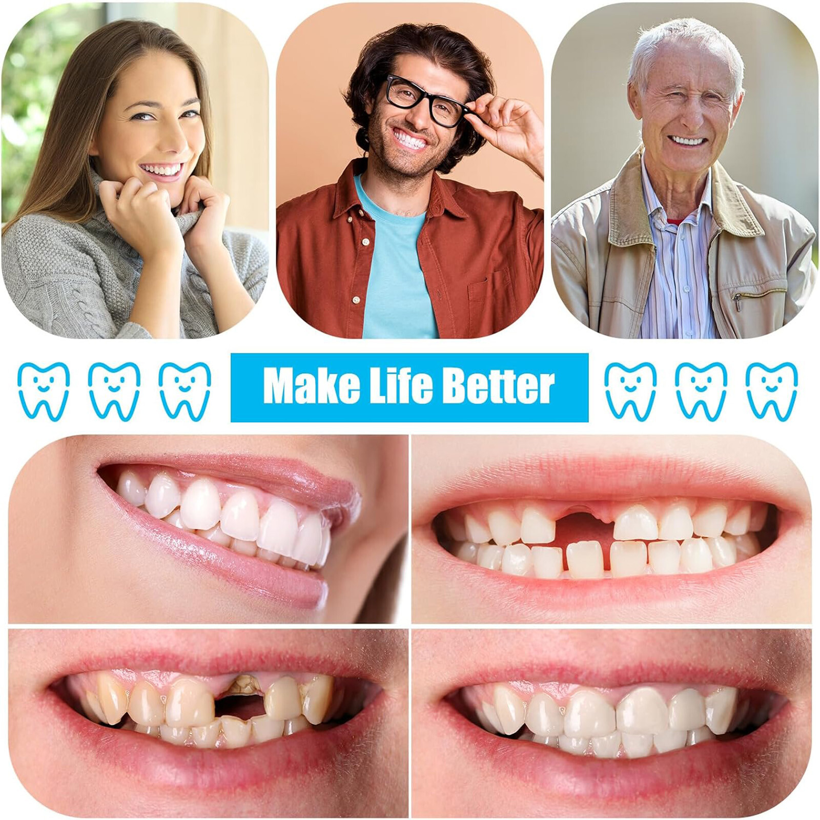 2 Set DIY Dentures Fake Teeth Kits Top and Bottom Dentures Temporary Fake Teeth