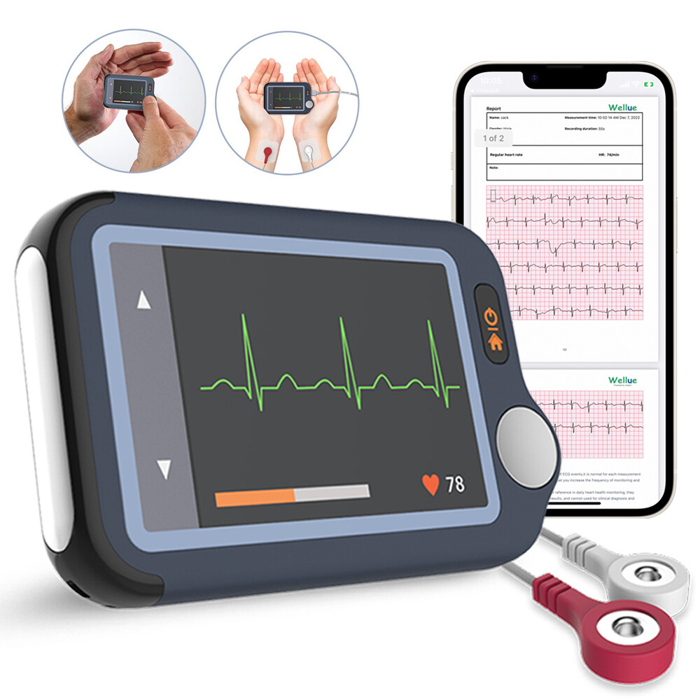 Touch Screen EKG Monitor Heart Monitor with ECG Cable AI-ECG Analysis via App