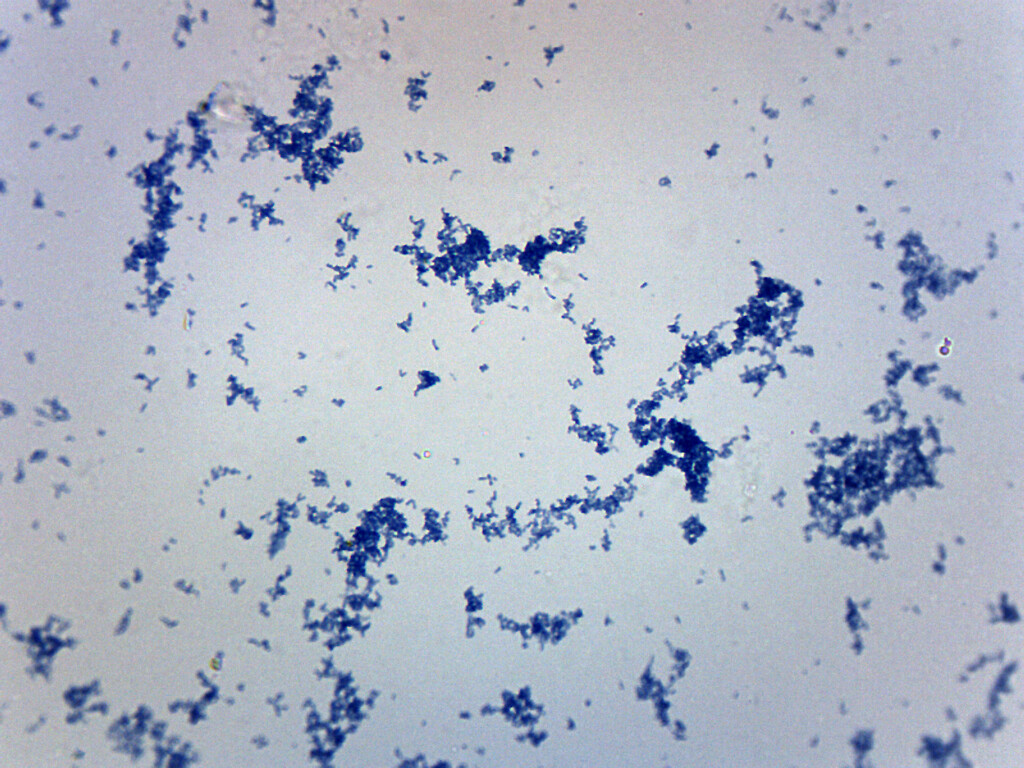 Corynebacterium Diphtheriae - Prepared Slide - 75x25mm - Eisco Labs