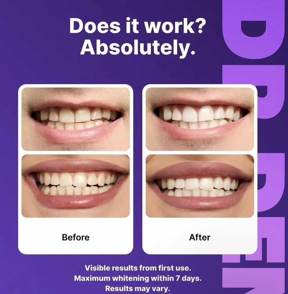 DR.DENT Purple Teeth Whitening Strips – Peroxide Free, 14 Count