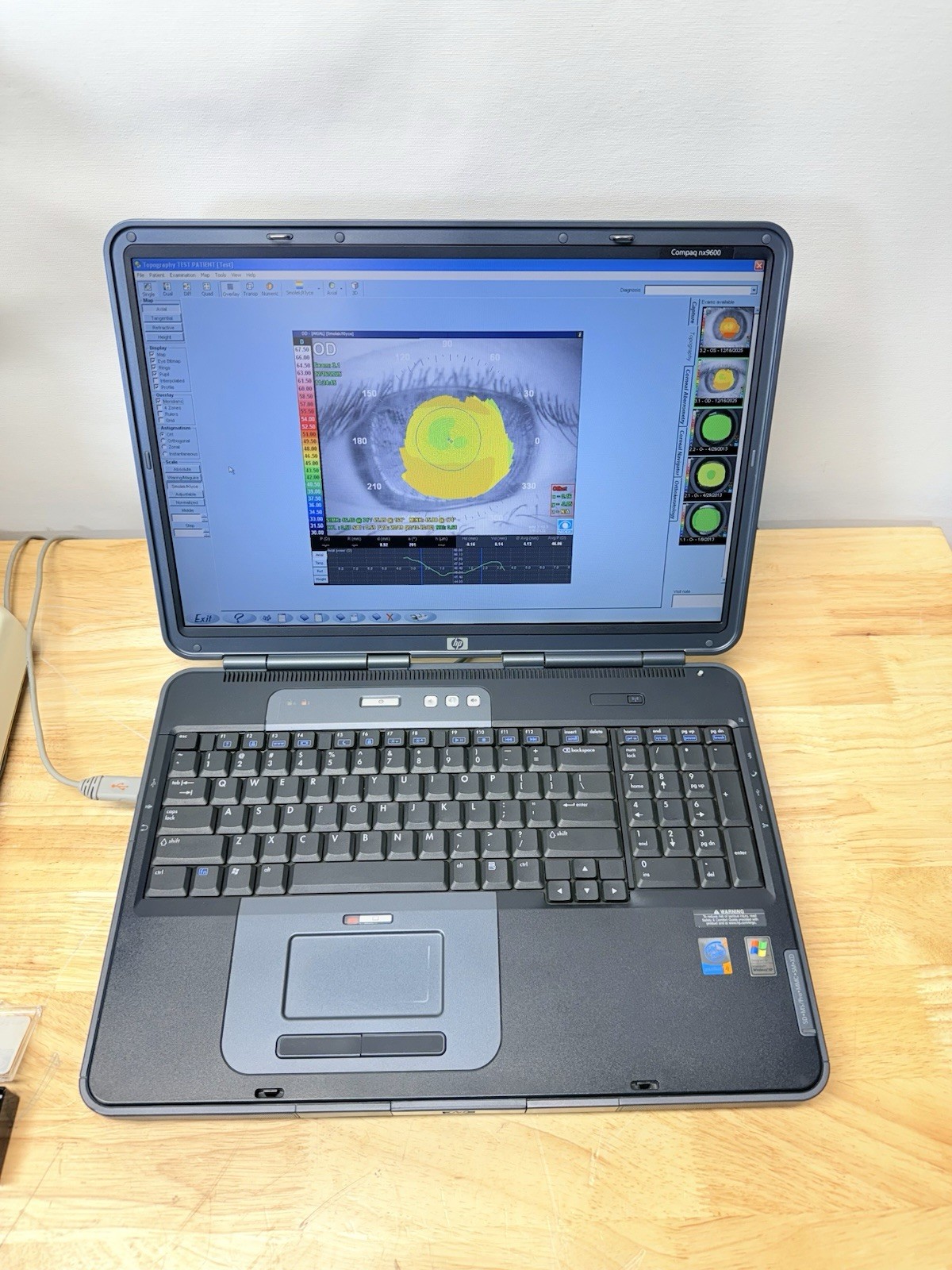 Nidek Magellan Corneal Topographer w/ Software