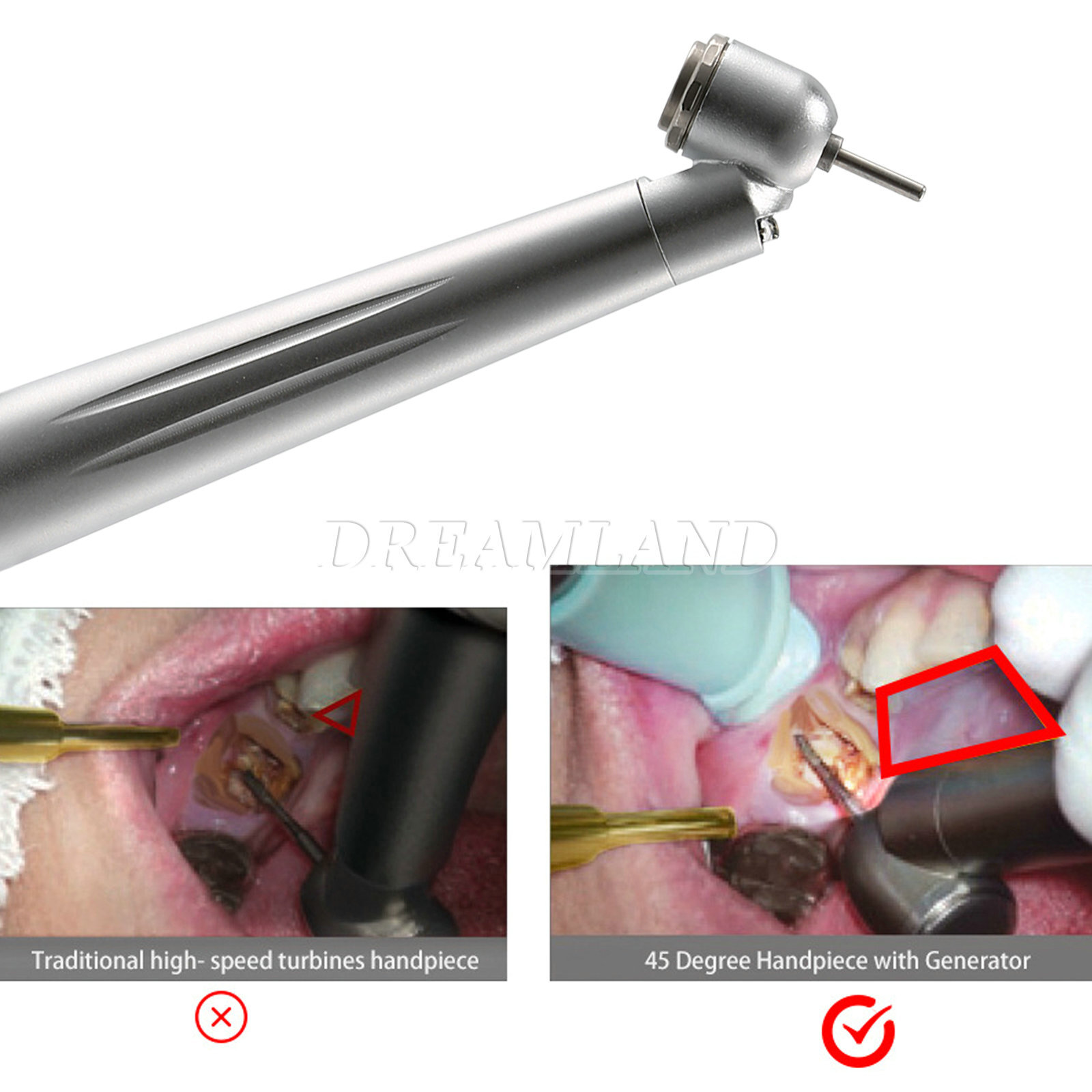Dental 45 Degree Surgical High Speed Handpiece Led E-generator Push Button 4Hole