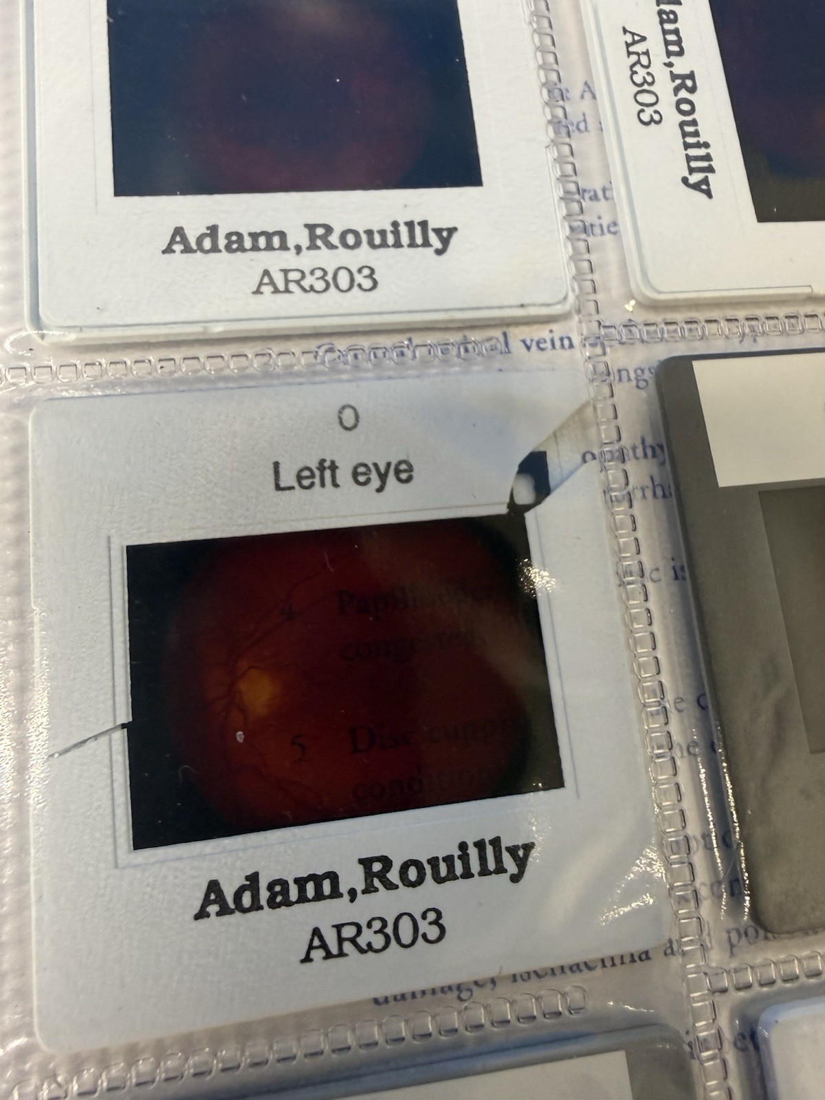 Kyoto Kagaku M82A EYE Examination Simulator Head (2 Steps) -Pls Read Description