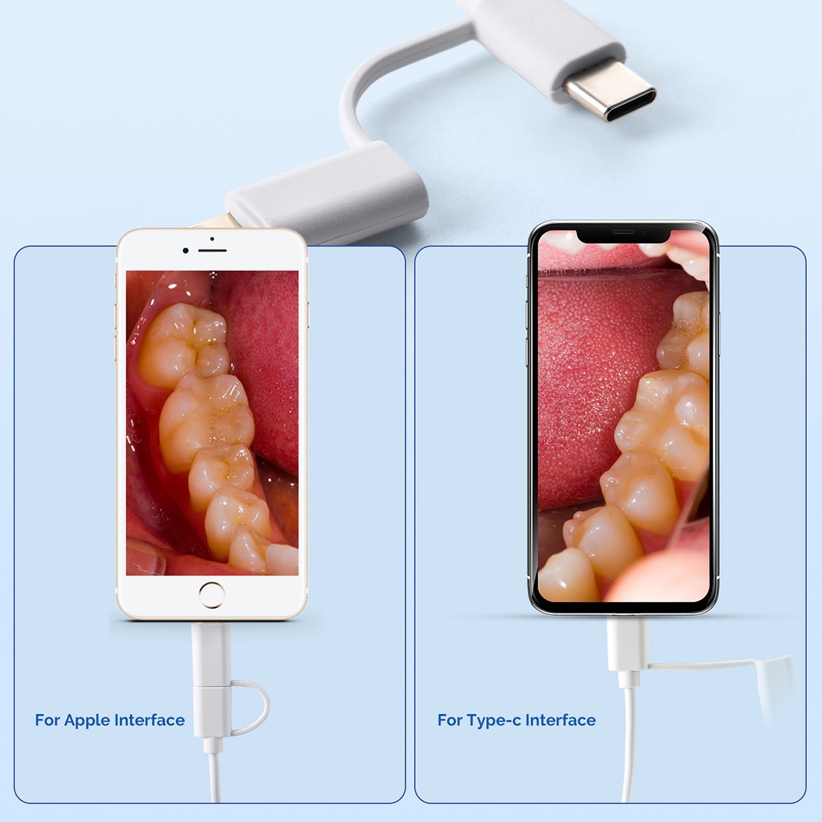 Dental Oral Endoscope USB Intraoral Camera 8 LED light Apple&Type-C 1M cable