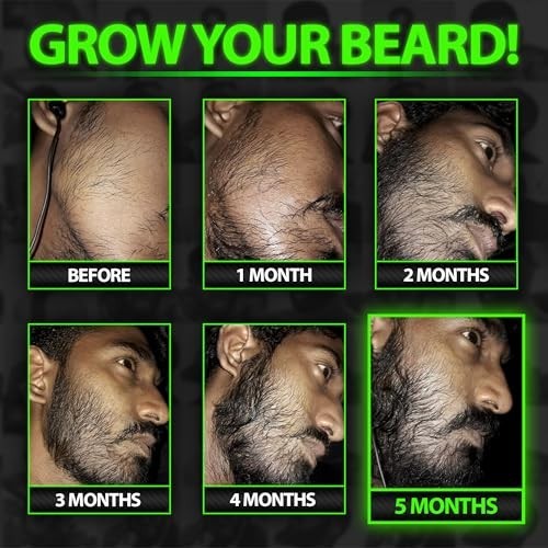Beard Growth Serum - GROW Maximum XXL Beard Growth Oil for Men -Thickens & Fills