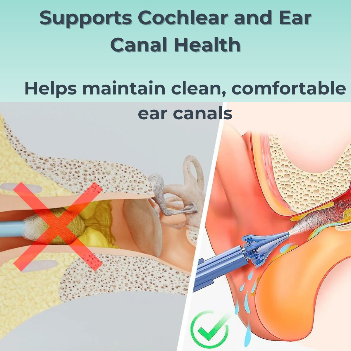 MediLisk Hearing Restoration Spray – Earwax Cleaning & Ear Care Solution 1 Floz