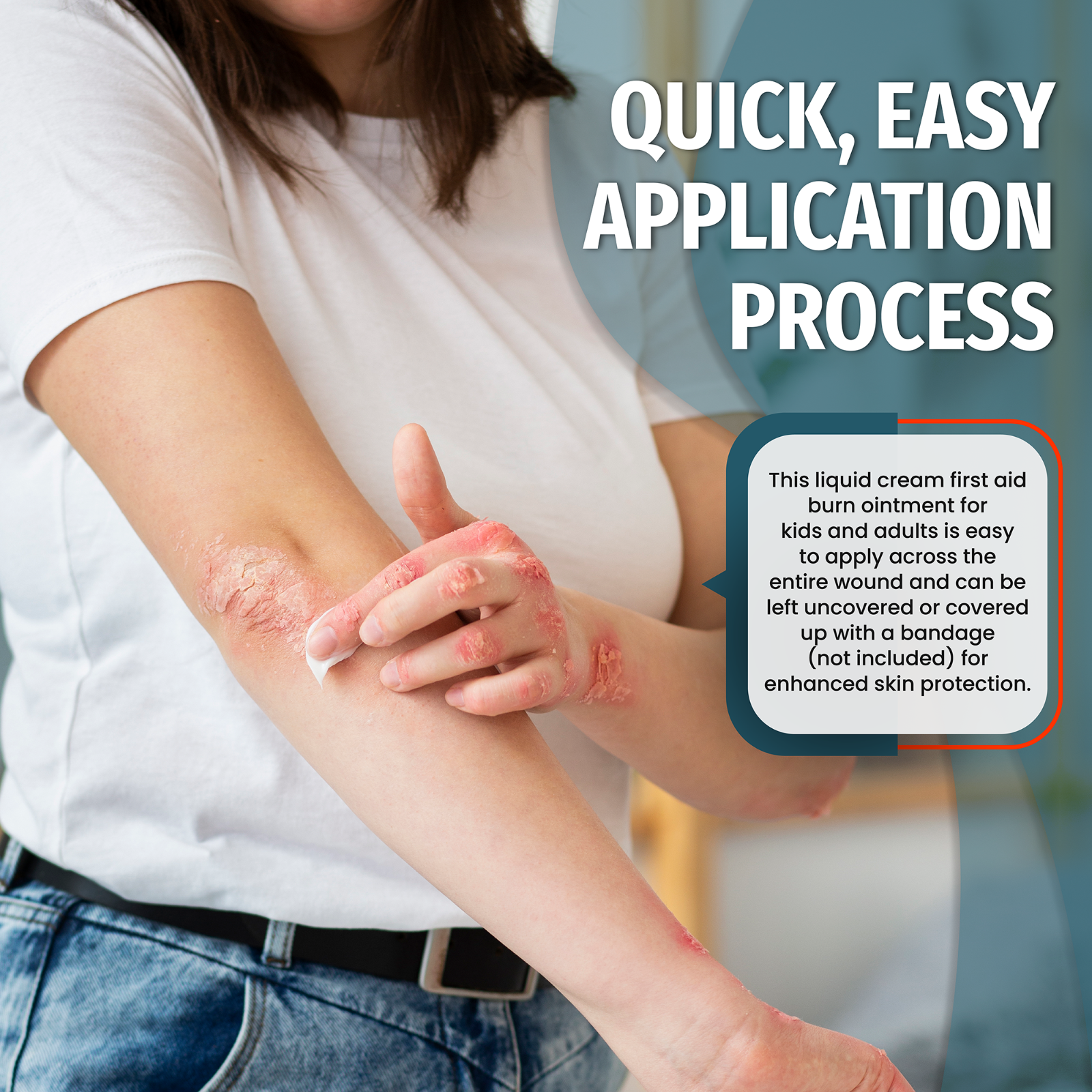 Epic Medical Supply First Aid Burn Relief Cream .9g Packets Box of 144