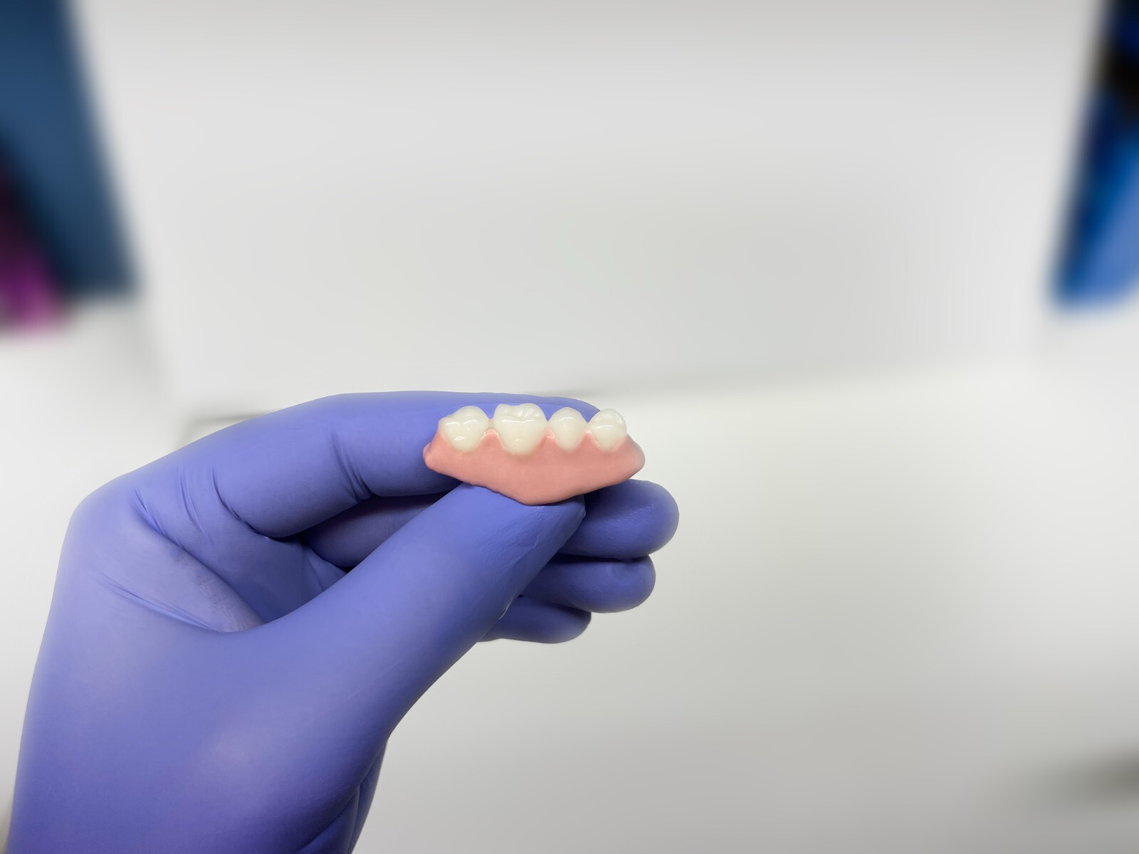 I made my own homemade dentures with Denturi