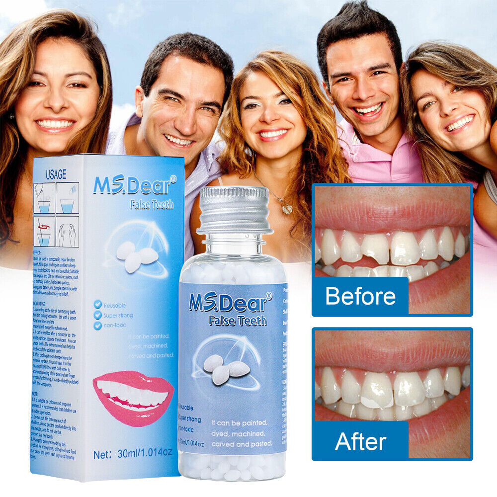 3/2X Tooth Repair Granules Temporary Fitting Beads Reusable Moldable False Teeth