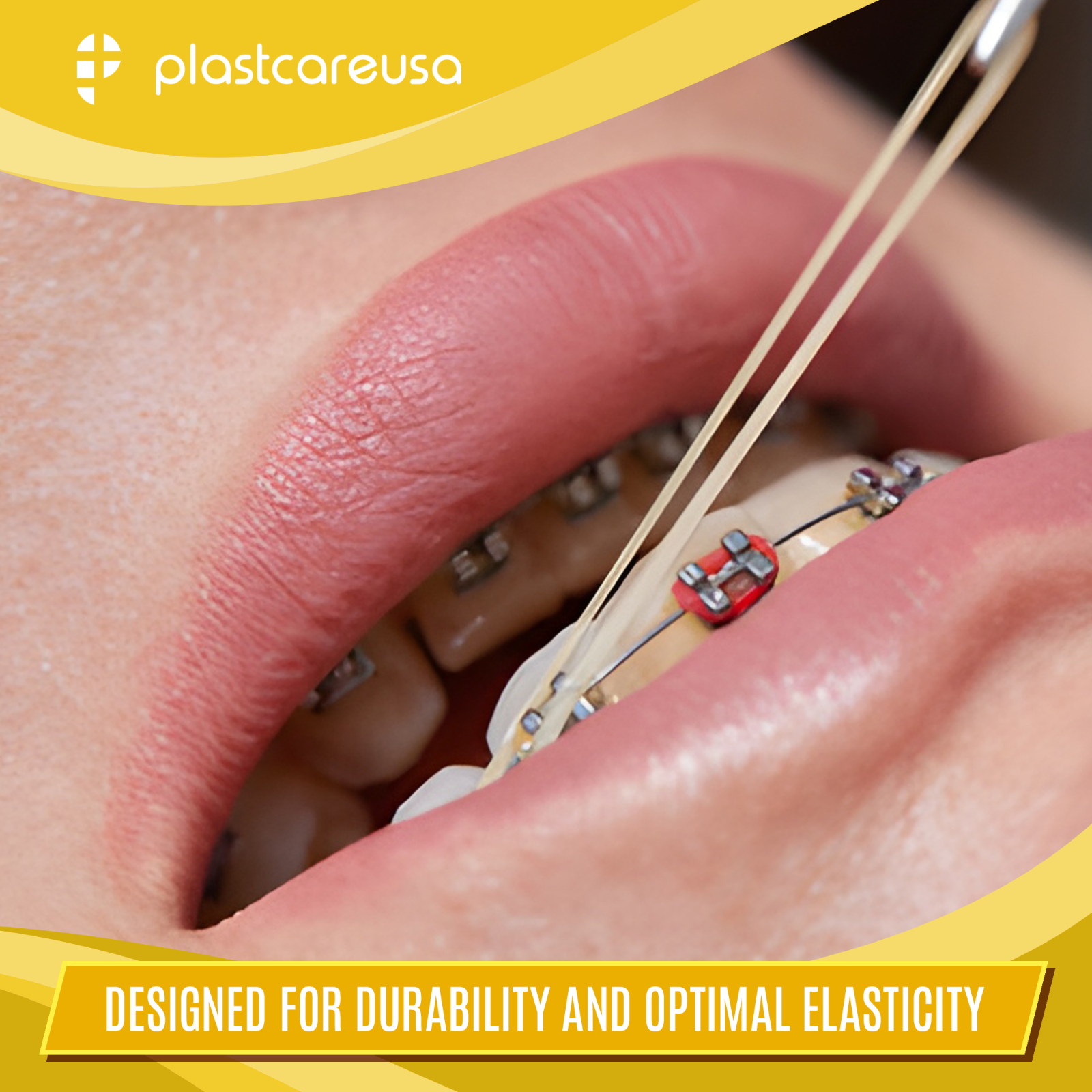 100 Medium 4.5 Oz 3/16" Rabbit Orthodontic Latex Elastic Rubber Bands Braces