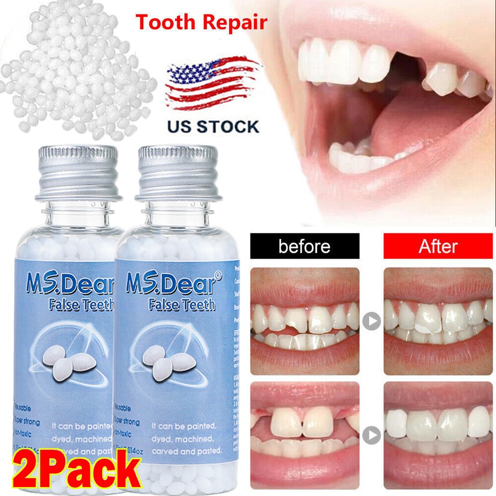 2X Tooth Repair Kit - Temporary Teeth Replacement Kit for Missing & Broken Teeth