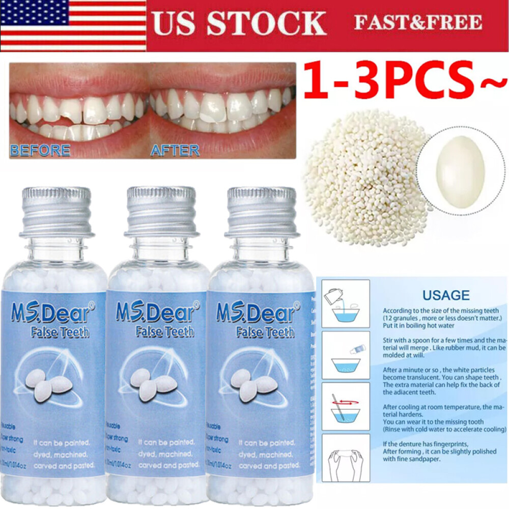 3/2X Tooth Repair Granules Temporary Fitting Beads Reusable Moldable False Teeth