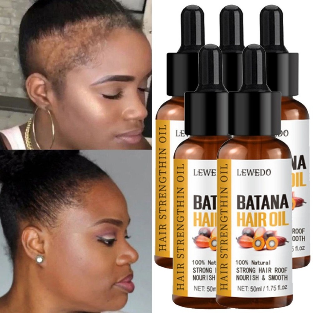 100% Pure Herbal Hair Growth Oil Shampoo Anti hair Loss Hair Regrowth Treatment