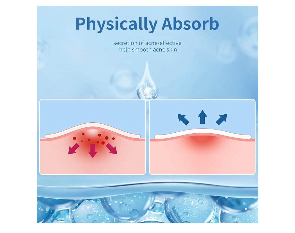 Pimple Patches for Face, 4 Size 300 Counts Acne Patches