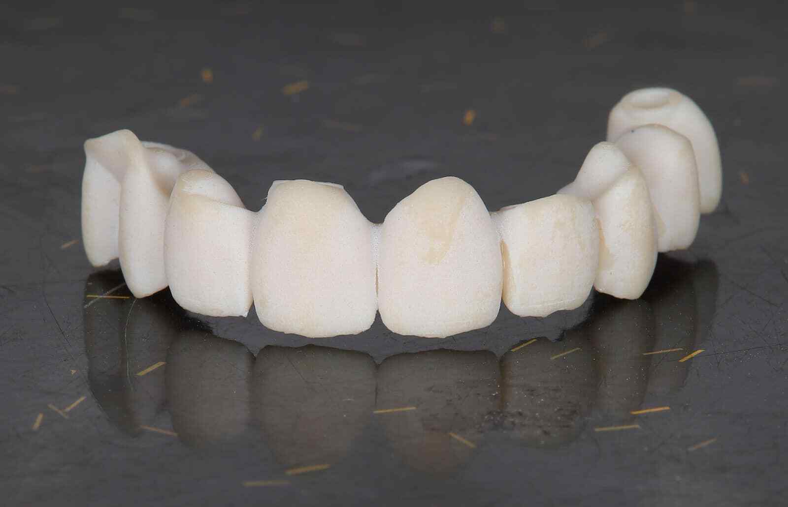 DLP SLA LCD 3d printer ALL ON X resin - for all on x cases, bridges,arcs, hybrid