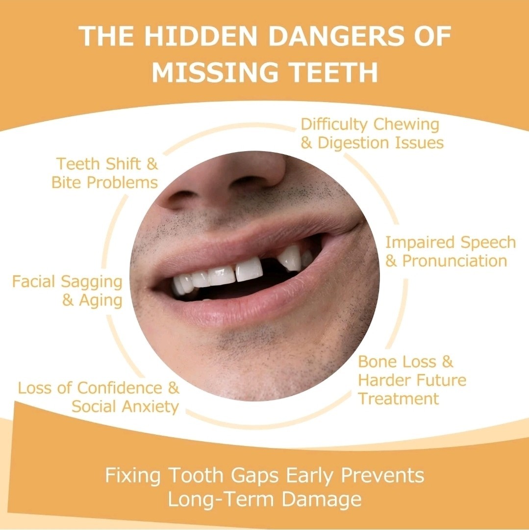 Partial Dentures - Dentures for Missing Teeth & Gaps - Lightweight & Unbreaka...