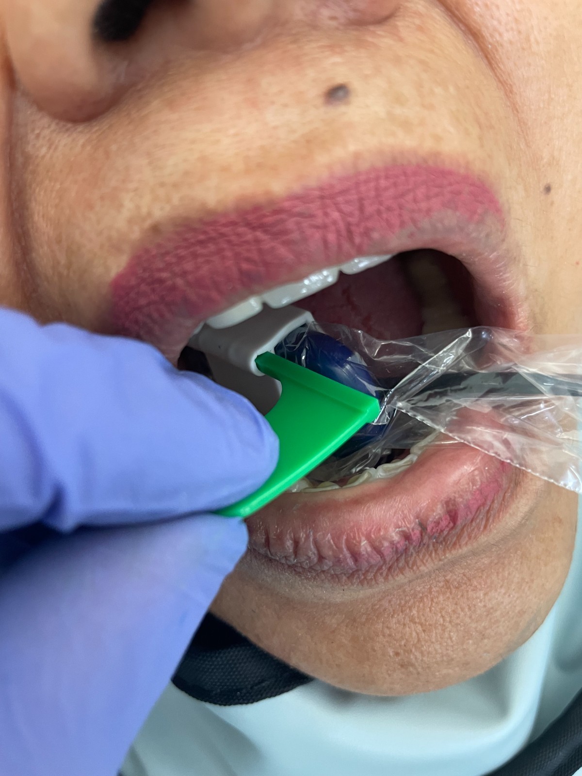 60 pcs Autoclavable - Apical/Bitewing Adult Digital Sensor Positioner-Holder